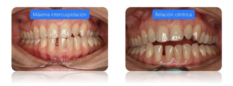 Cu Les Son Los Esc Neres Intraorales Aceptados Por Spark