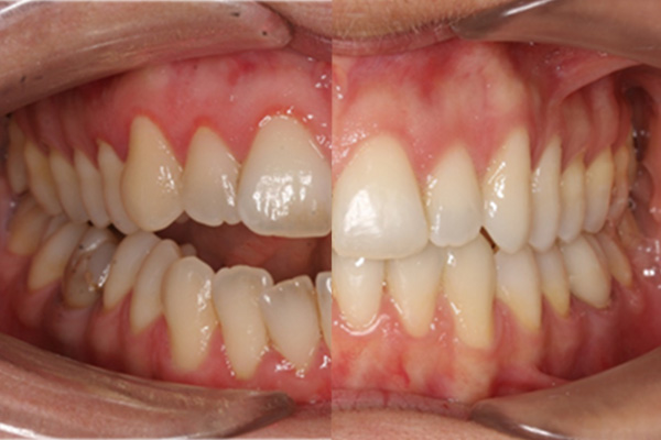 Casos clinicos ortodoncia
