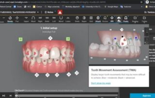 Tutorial ClinCheck Pro 6.0