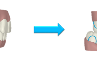 precision cut