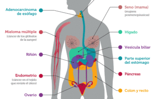 Cancer asociados a obesidad