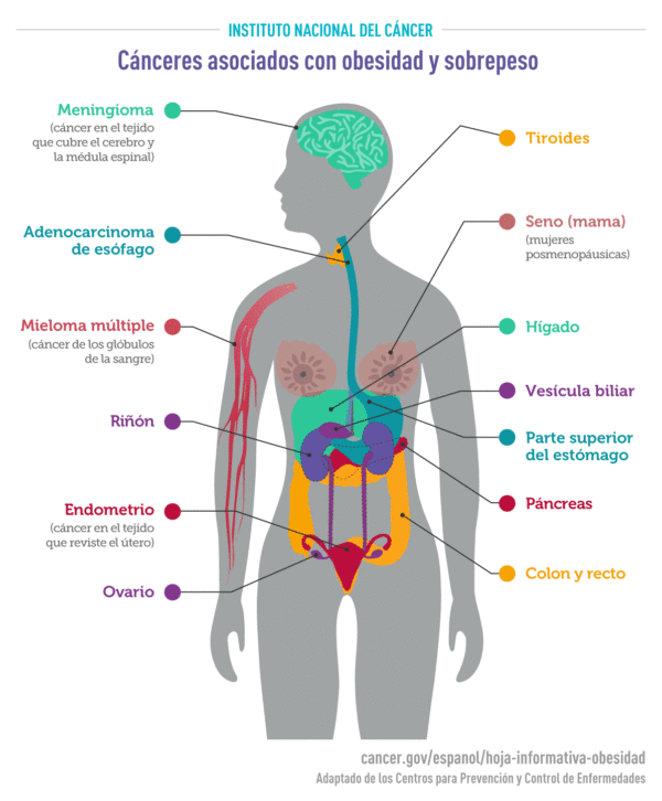 Cancer asociados a obesidad